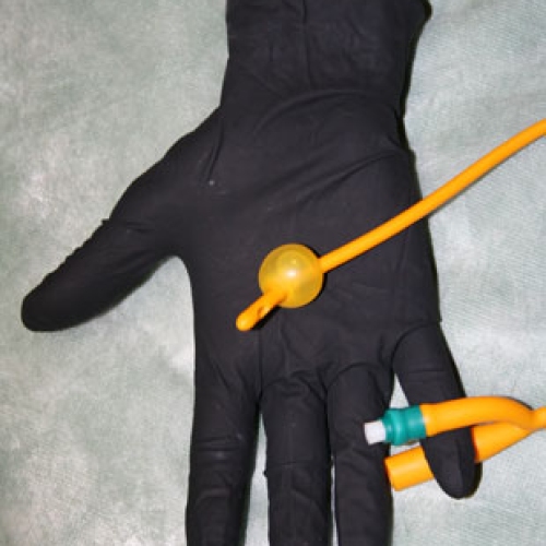 Foto 3 von 8 -  Katheter